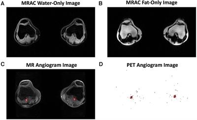 Effects of dynamic [18F]NaF PET scan duration on kinetic uptake parameters in the knee